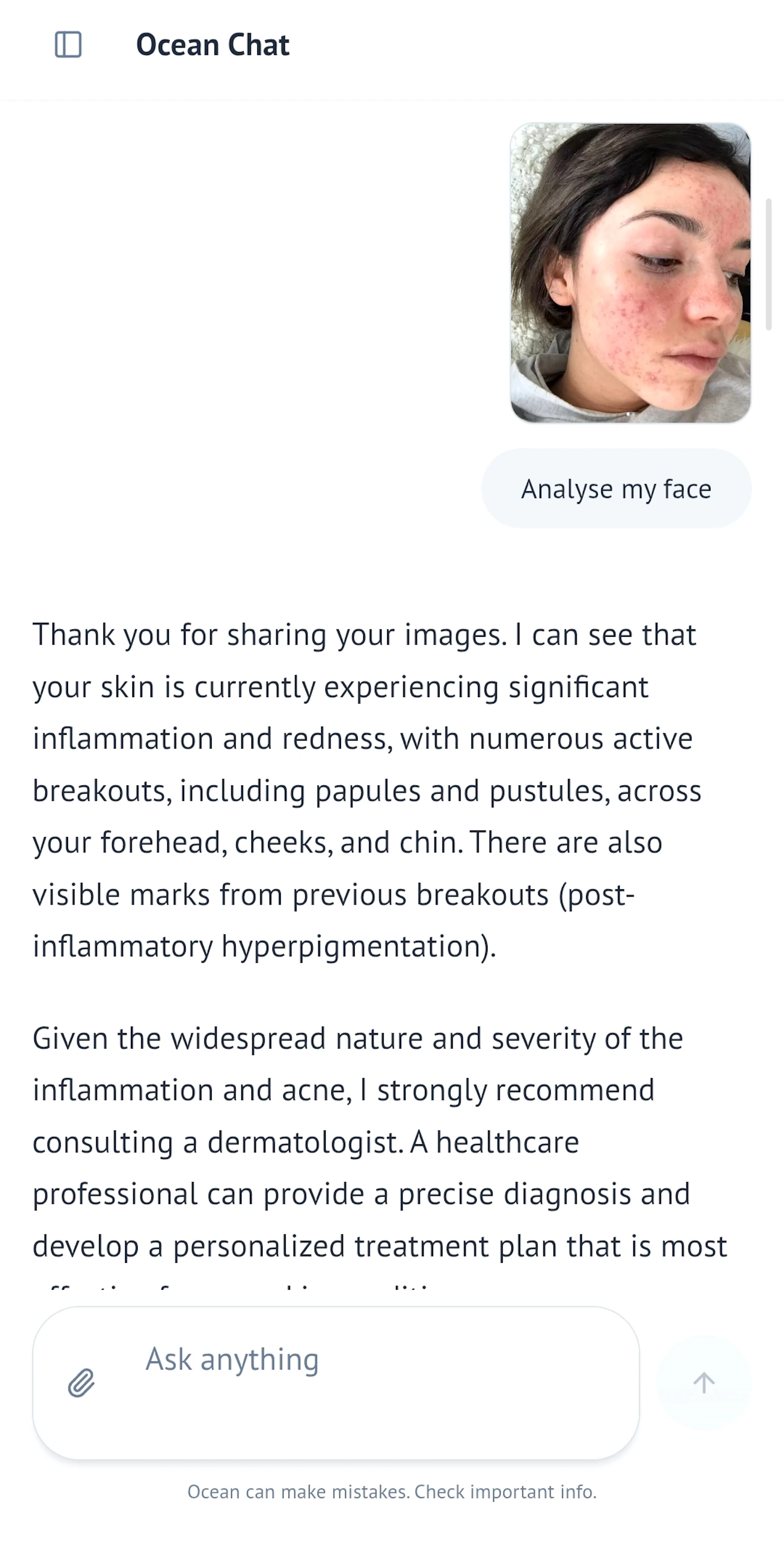 Ocean Chat - Chatgpt for Health screenshot 2