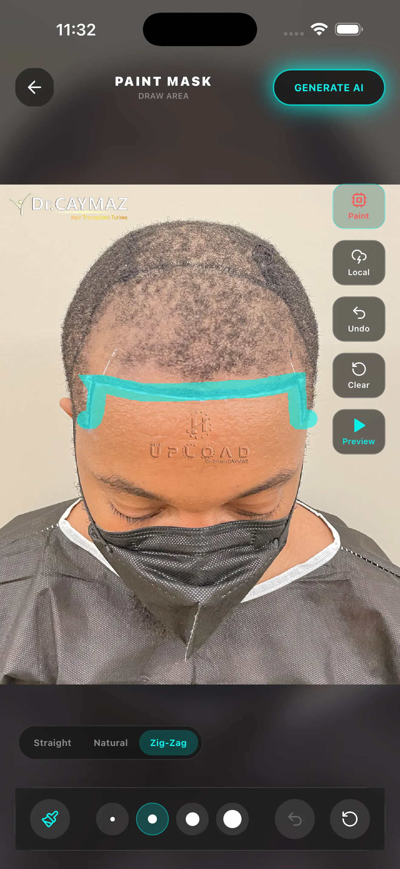 HairArchitect: AI Transplant gallery image