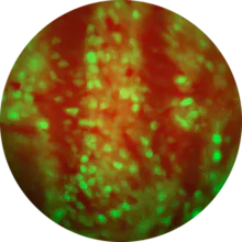Neurotransmitter Imaging gallery image