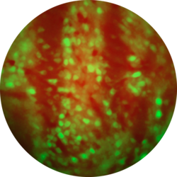 Média Imagerie des neurotransmetteurs - Dynamique d'imagerie des neurotransmetteurs dans les régions du cerveau profond 2
