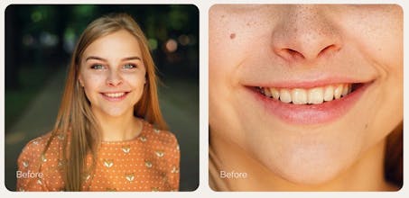 Retouch4me White Teeth gallery image
