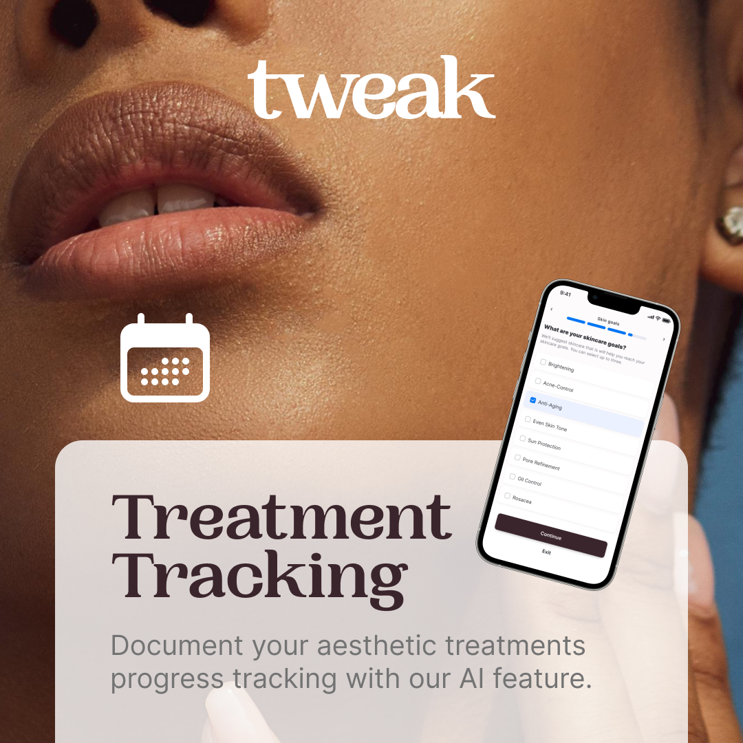 Tweak app  gallery image