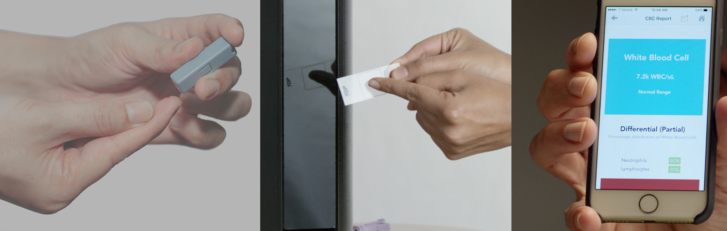 Athelas Screen 5 Mo Portable Blood Diagnostics Product Hunt