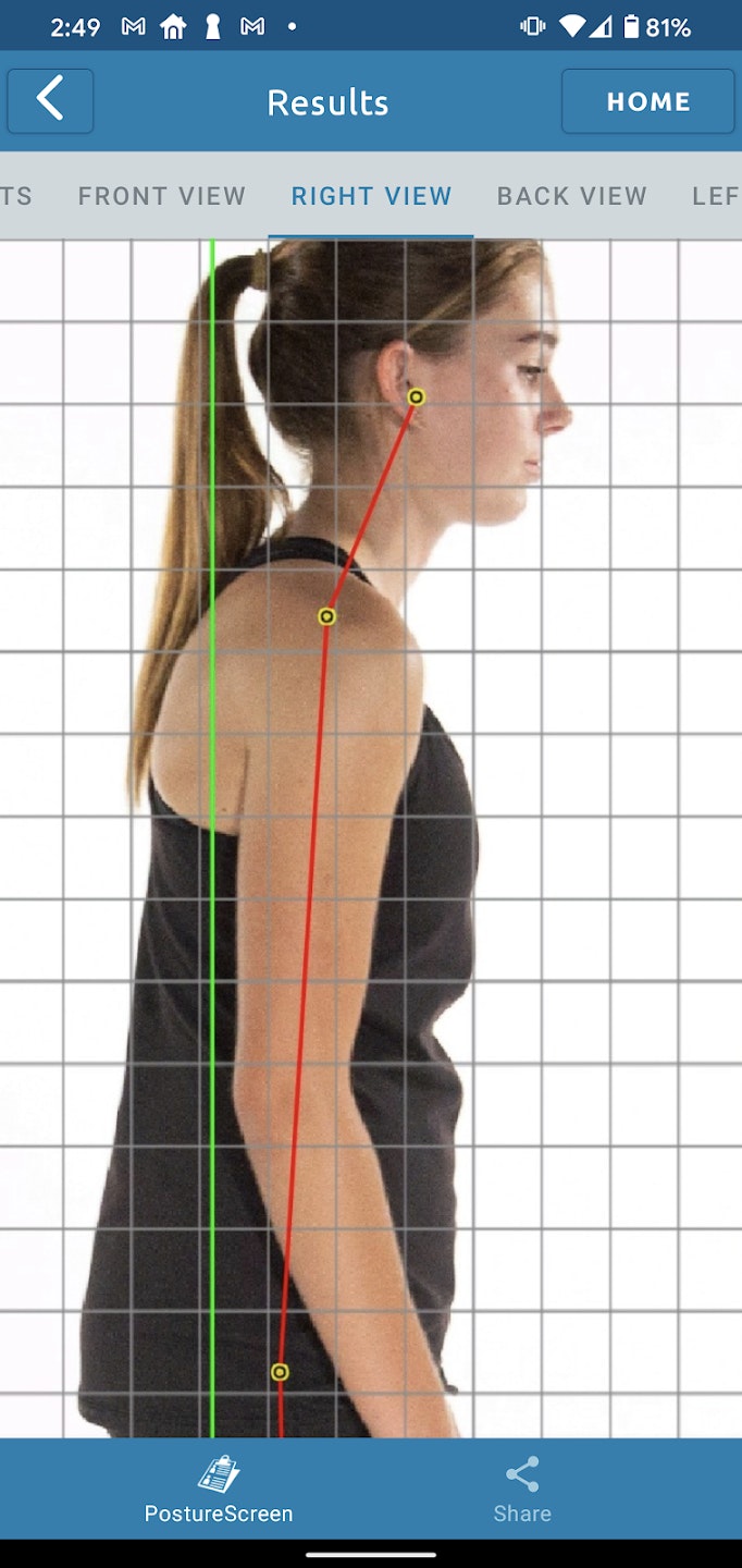 Posture Analysis gallery image