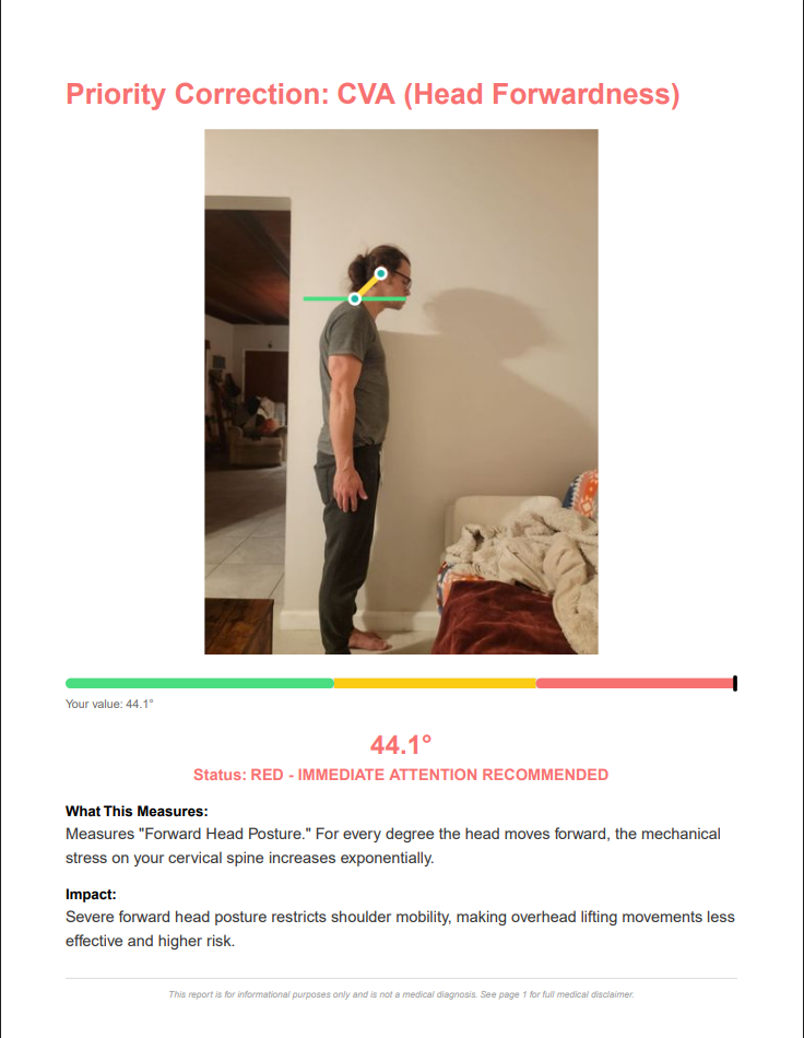 Free Posture Analysis gallery image
