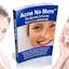 Acne No More