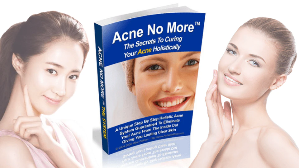 Acne No More