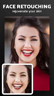 Pixl - Face Retouch & Blemish Remover gallery image
