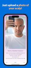 Hair Transplant AI Success gallery image