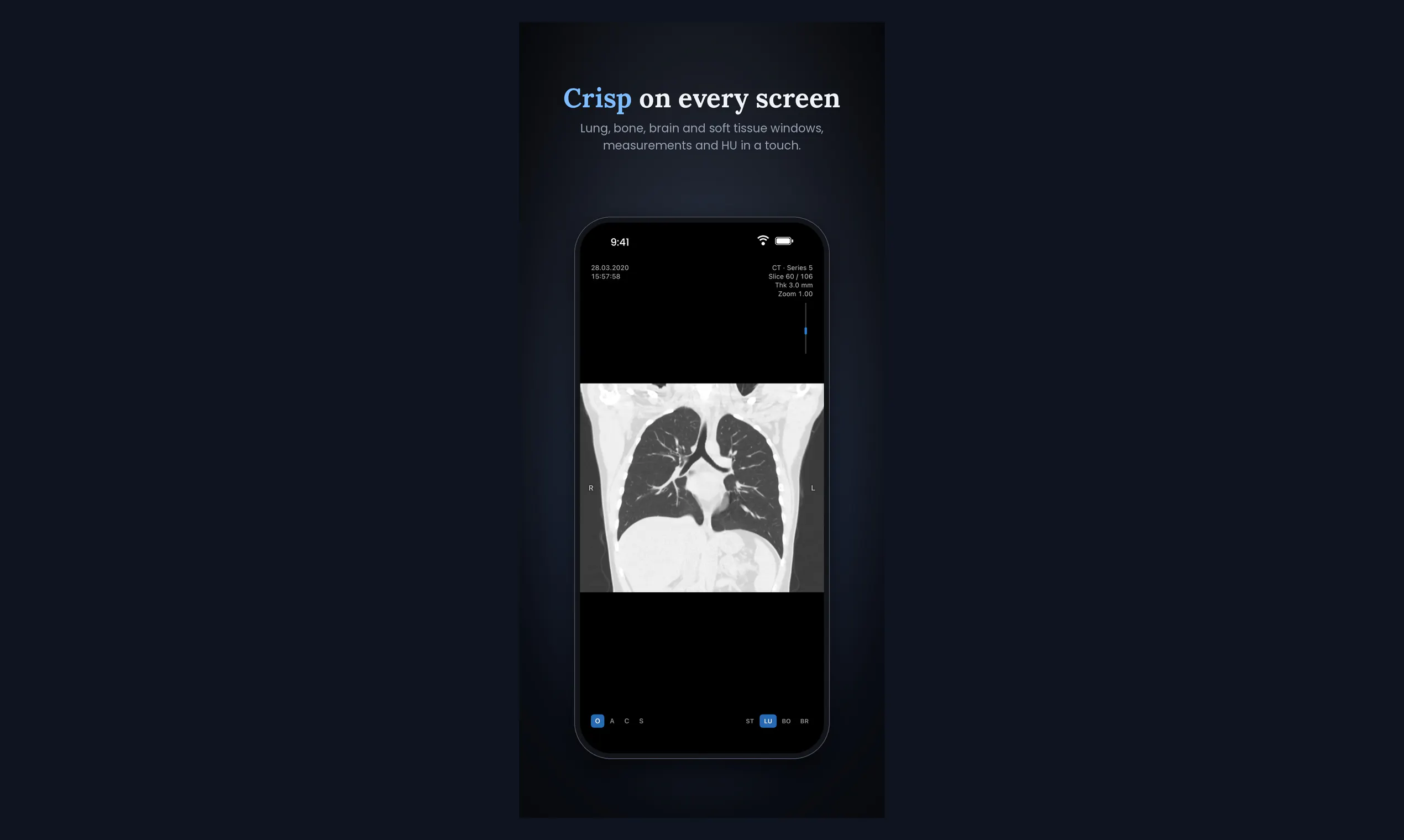 P Viewer gallery image
