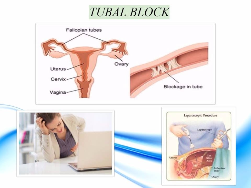 Infertility Treatment with Ayurveda