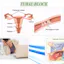 Infertility Treatment with Ayurveda