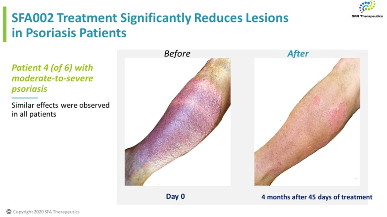 SFA002 gallery image