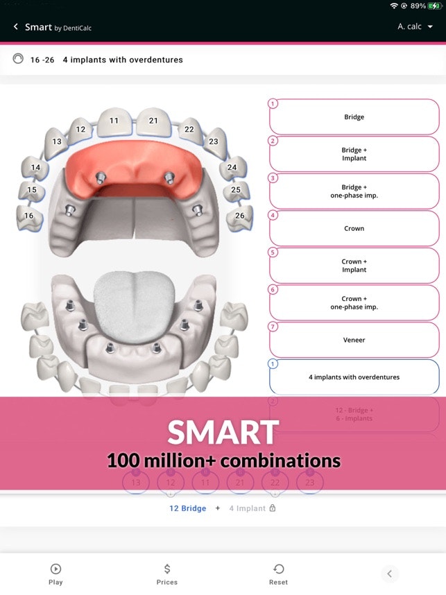 DentiCalc gallery image