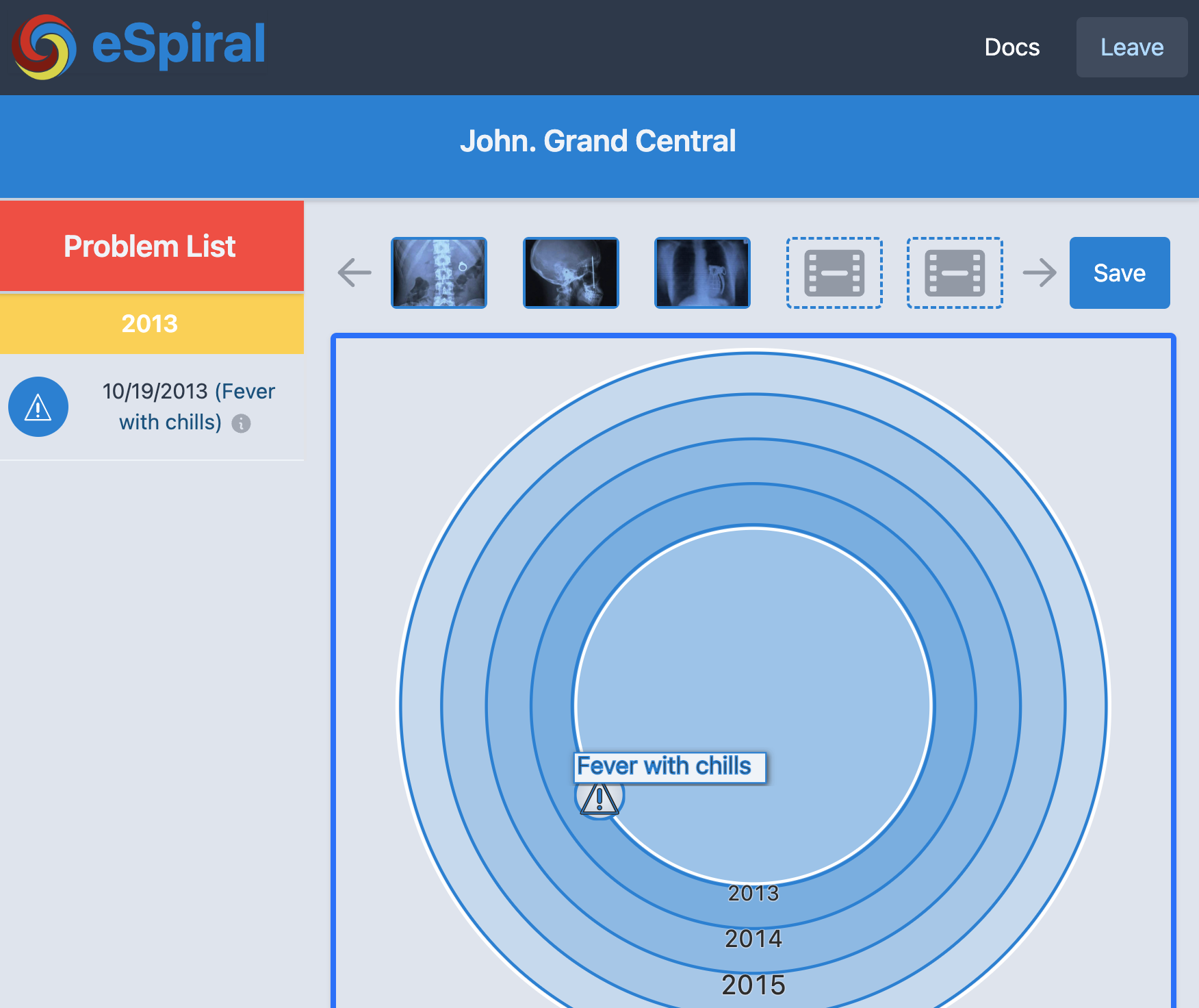 eSpiral - At-a-glance visualizations for clinicians media 3
