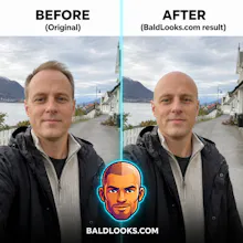 BaldLooks gallery image
