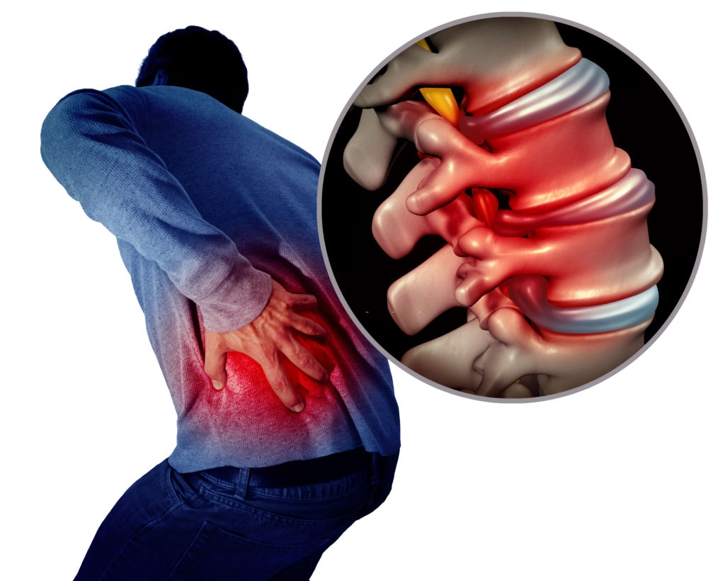 How do I relieve sciatica nerve pain?