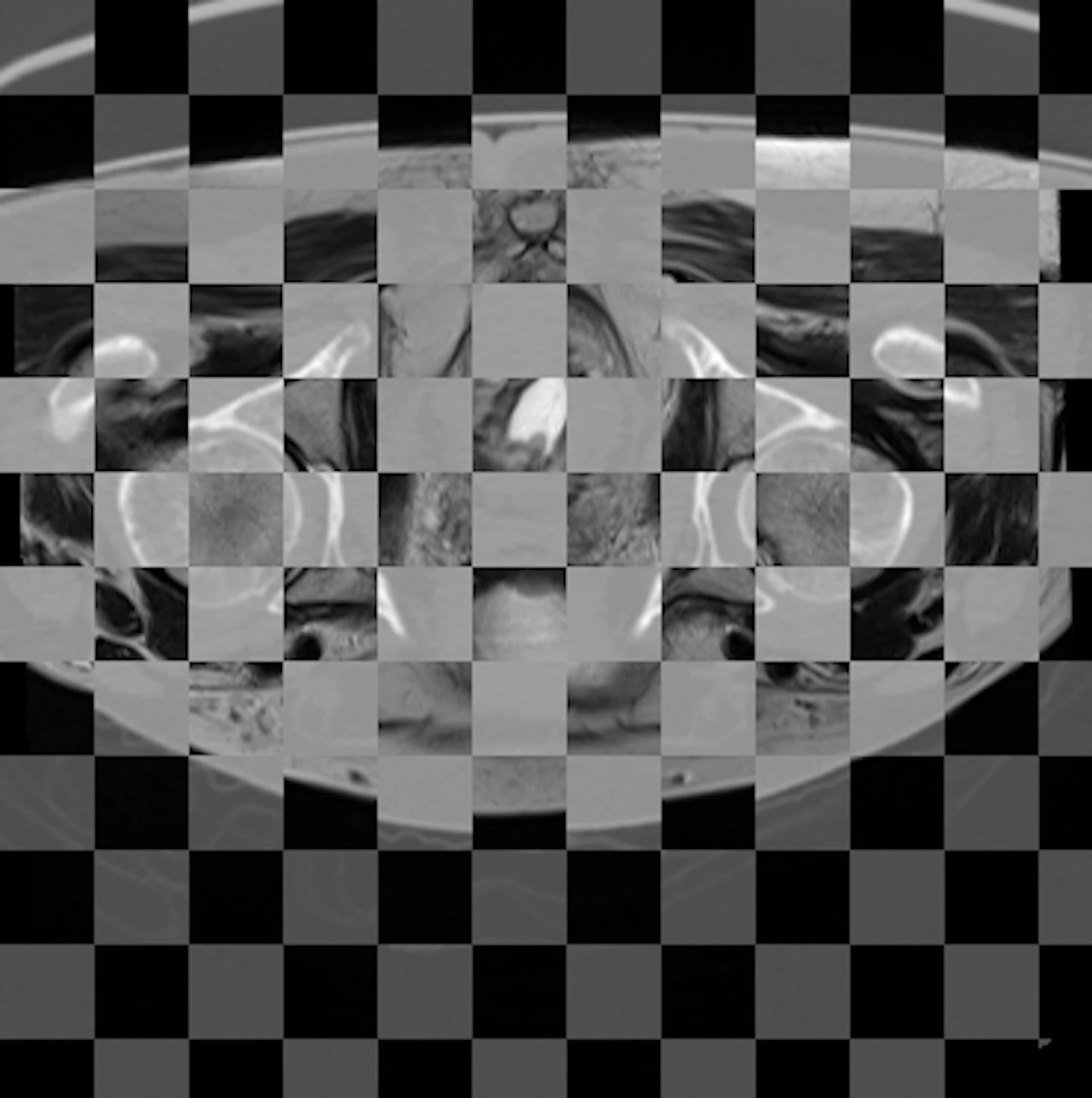 Multimodal image registration screenshot 6