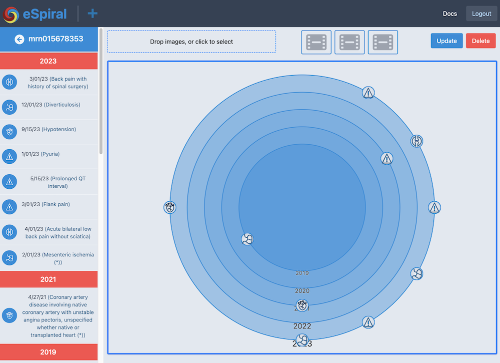 eSpiral - At-a-glance visualizations for clinicians media 1