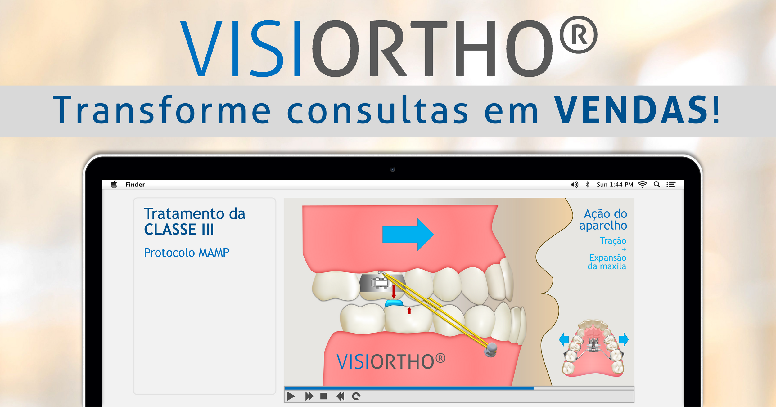 VISIORTHO gallery image