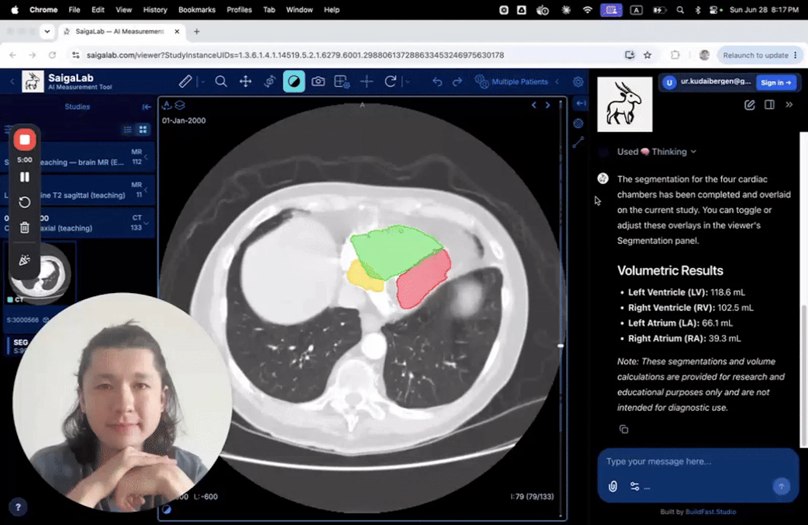 SaigaLab screenshot 1 (video preview)