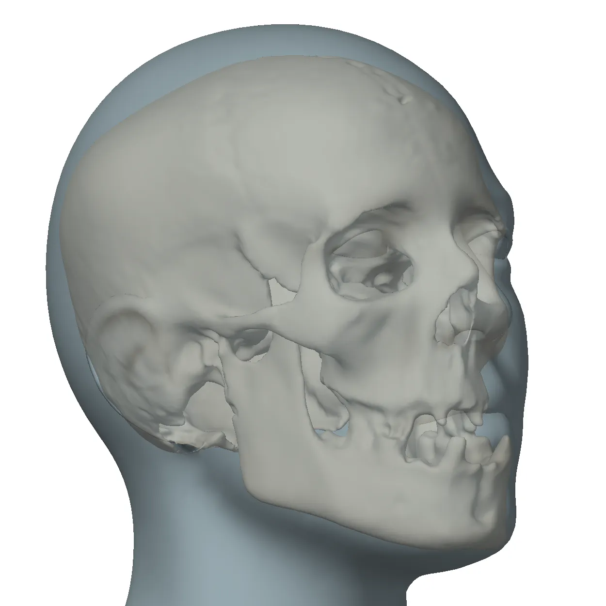 GNM Craniofacial Approximation gallery image