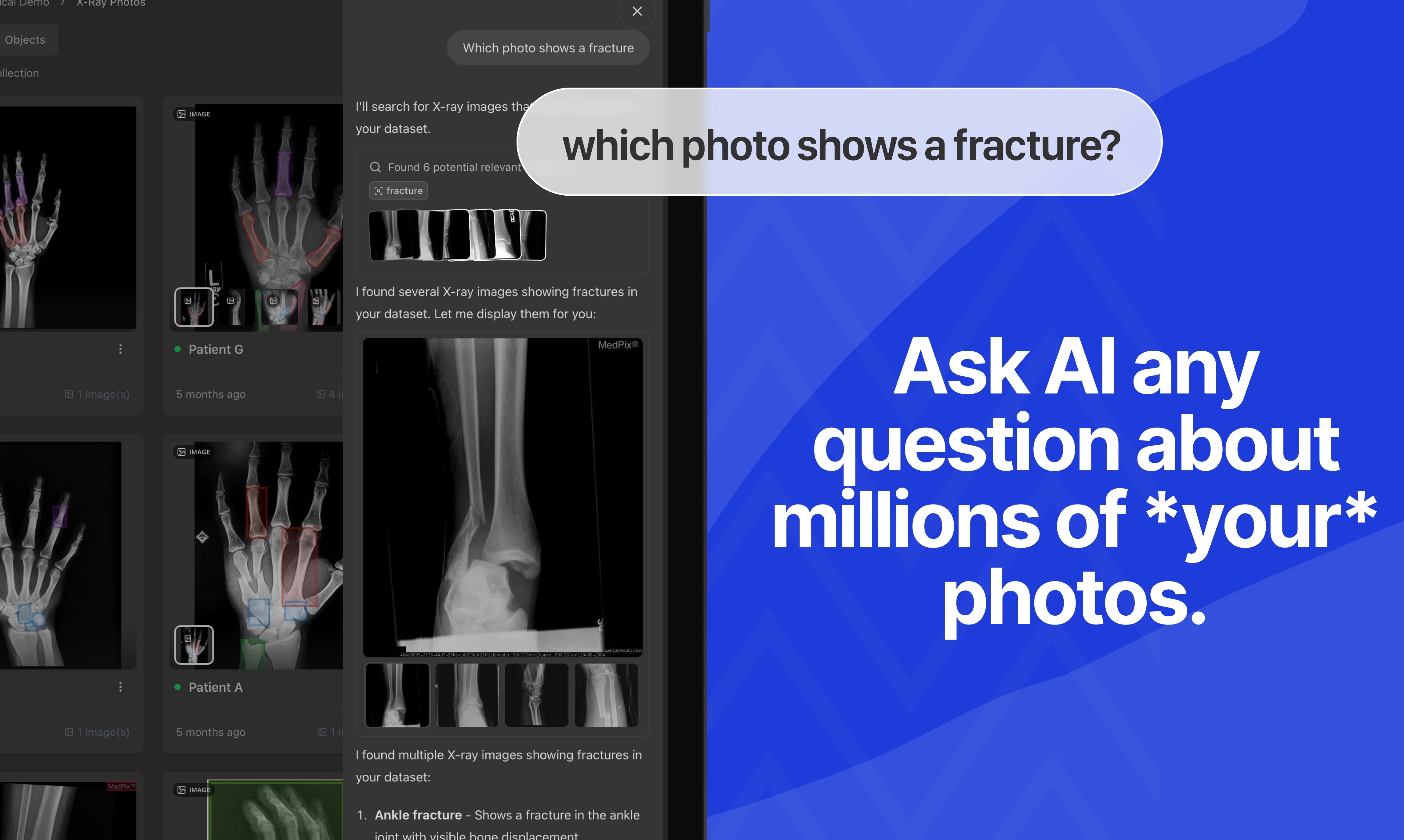 CoreViz – Your Photo Copilot - Screenshot 3 preview