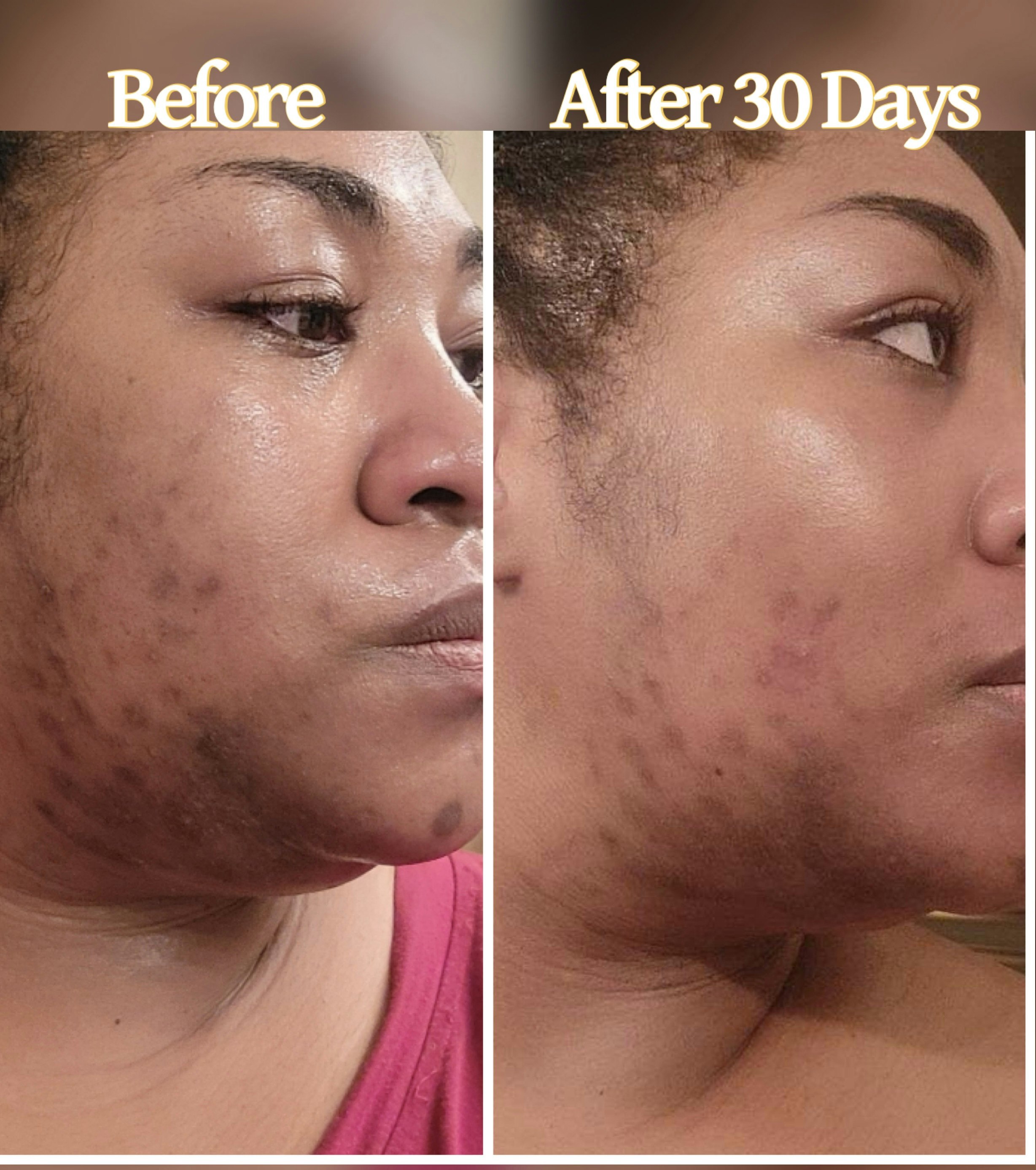 Mídia 4 de Finalmente tudo natural - Óleo de face revitalizante premiado