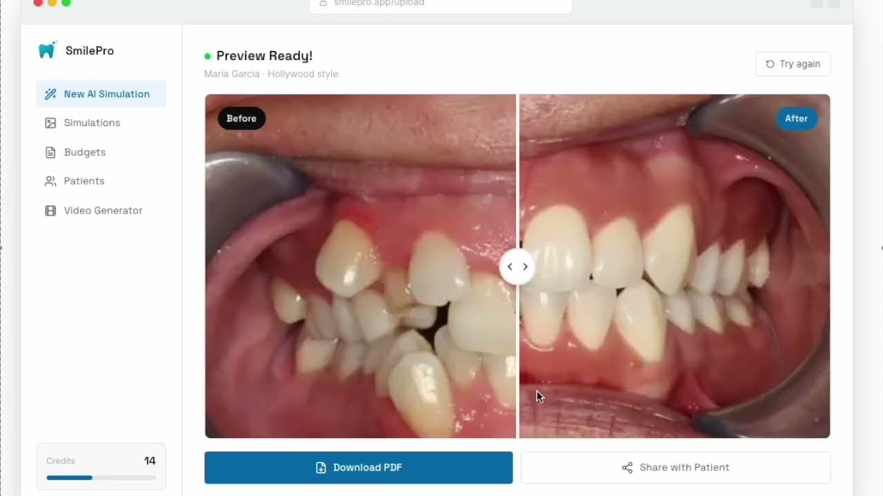 SmilePro AI Simulation for Dentists gallery image