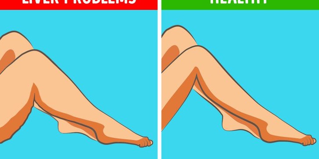 Live Science - These 9 Popular Legs Problem Can be A Signal Damaged Liver | Product Hunt