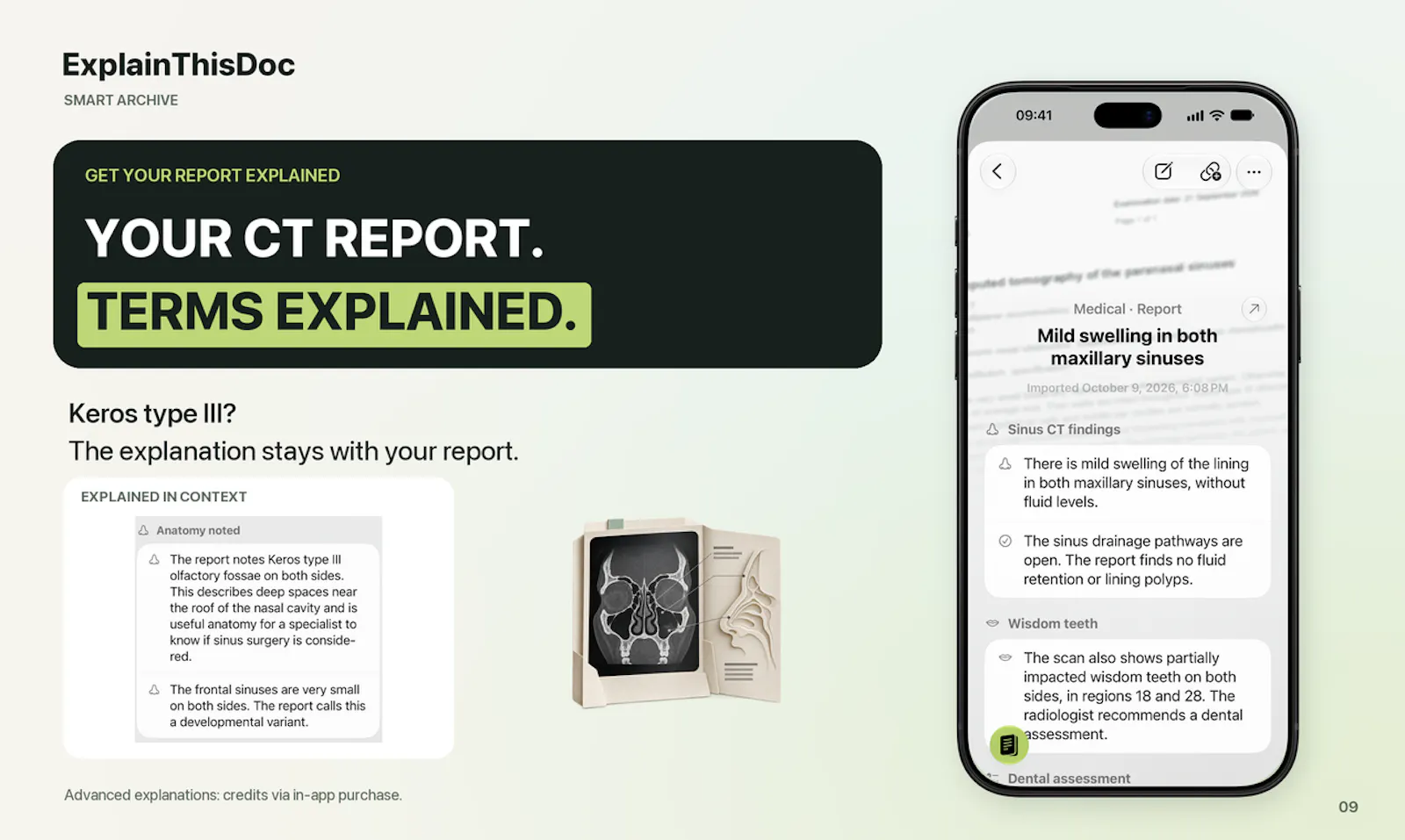 ExplainThisDoc: The Smart Archive Update screenshot 11