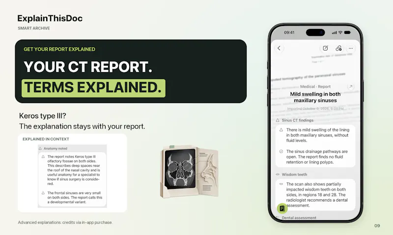 ExplainThisDoc: The Smart Archive Update screenshot 11