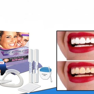 Laser Teeth Whitening Near Me