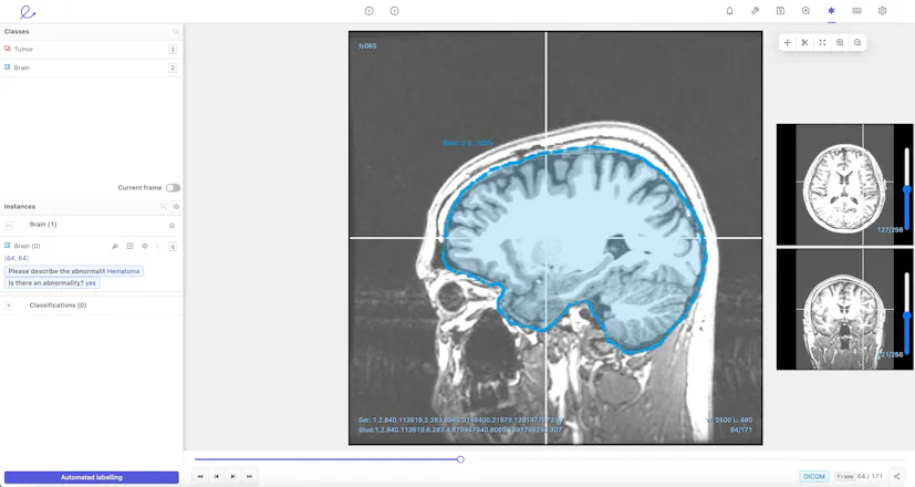 Encord DICOM Tool gallery image