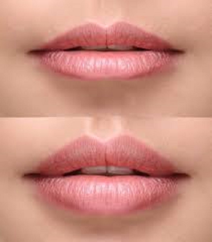 Skin Laser and Aesthetic Clinic gallery image