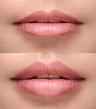 Skin Laser and Aesthetic Clinic gallery image