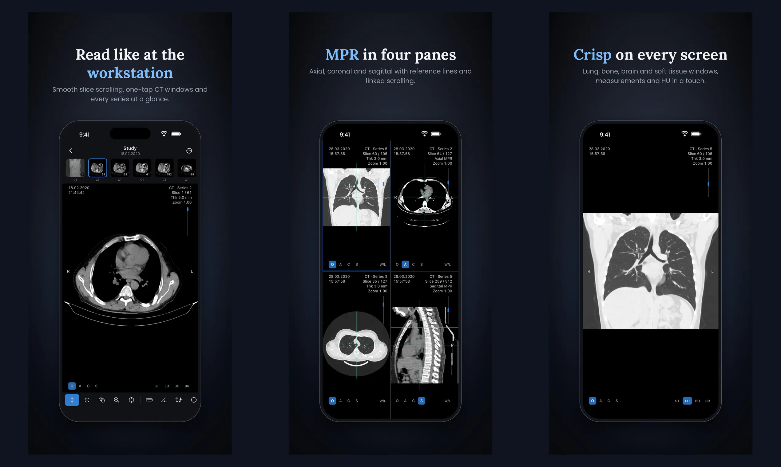 P Viewer gallery image