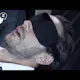 Snore Circle Mask