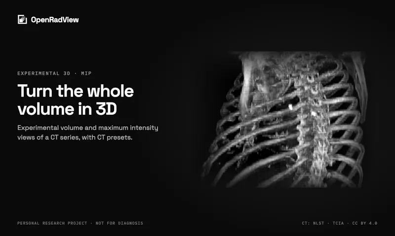 OpenRadView screenshot 2