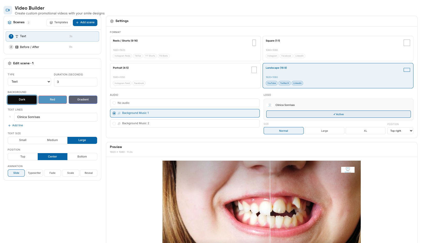SmilePro AI Simulation for Dentists gallery image