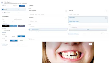 SmilePro AI Simulation for Dentists gallery image