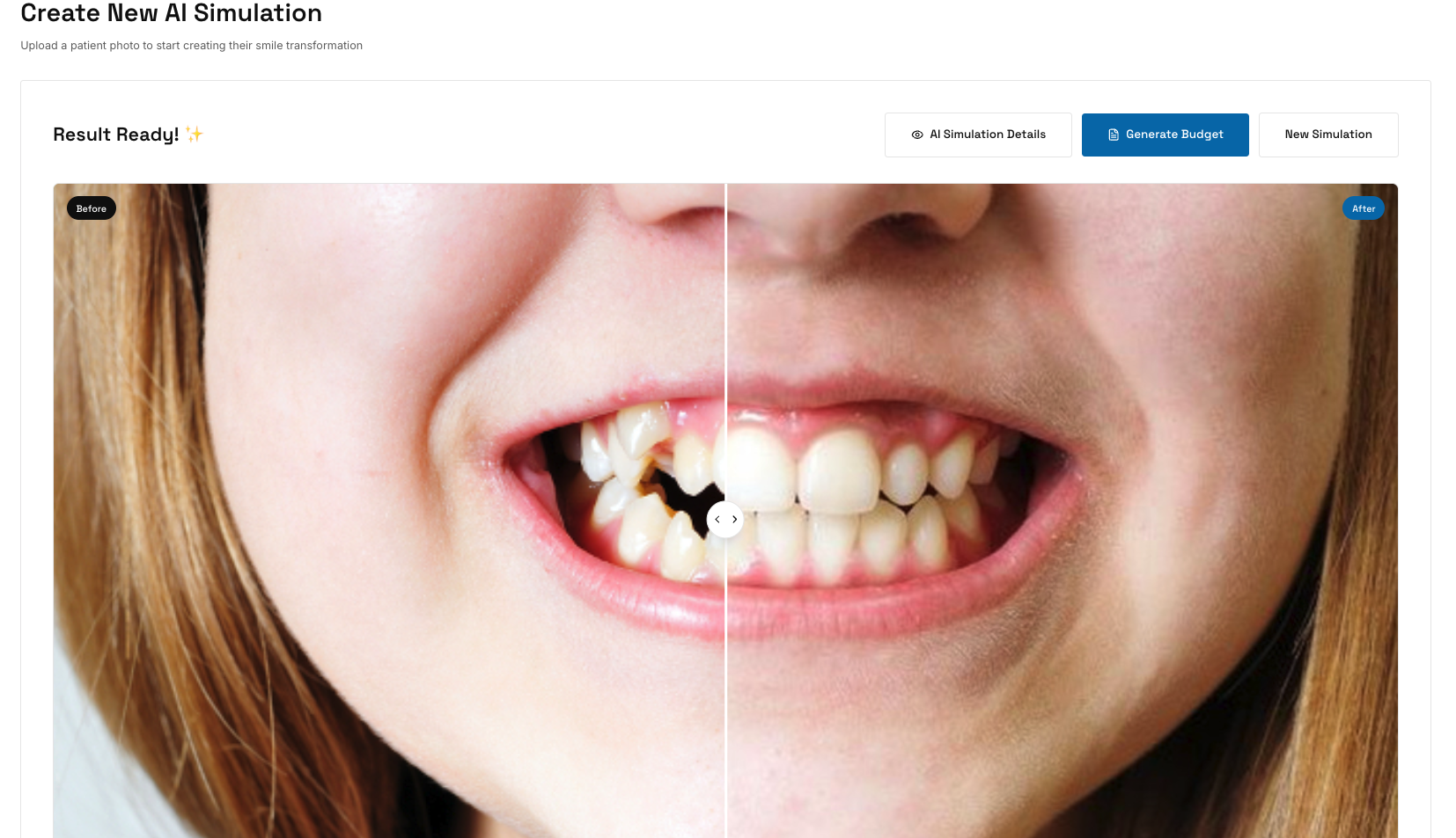 SmilePro AI Simulation for Dentists gallery image