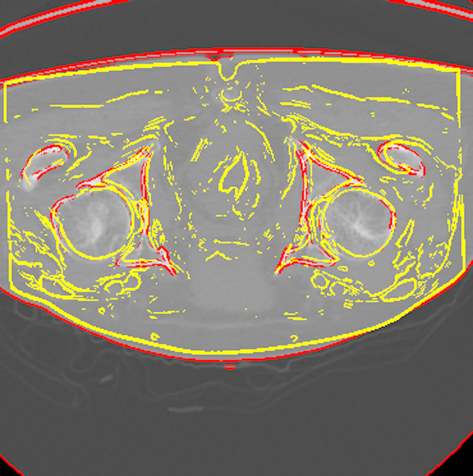 Multimodal image registration screenshot 5
