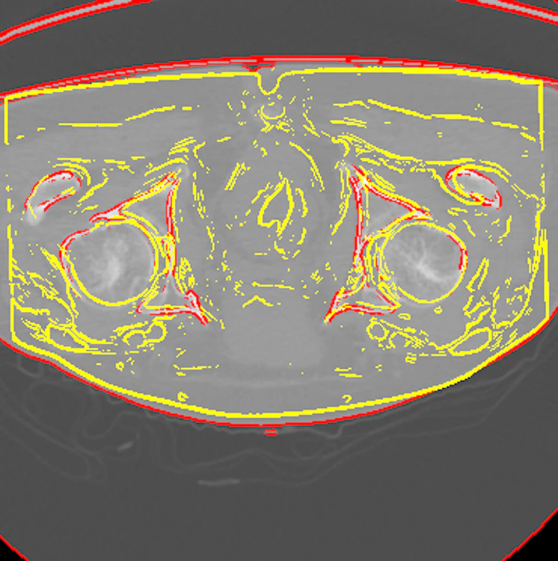 Multimodal image registration screenshot 5