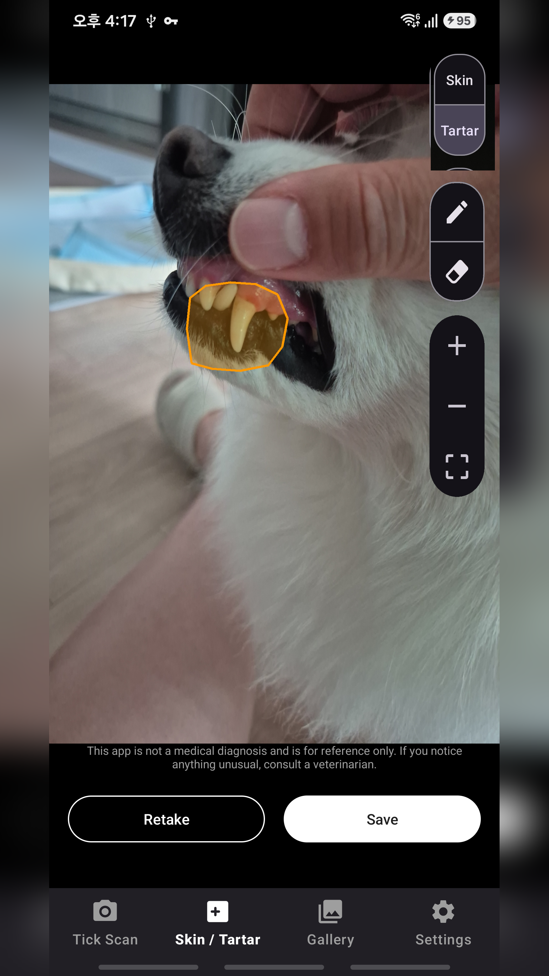 TickScanner gallery image