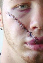 NewGel+ gallery image