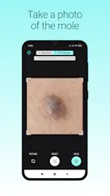 NOTA mole tracker gallery image