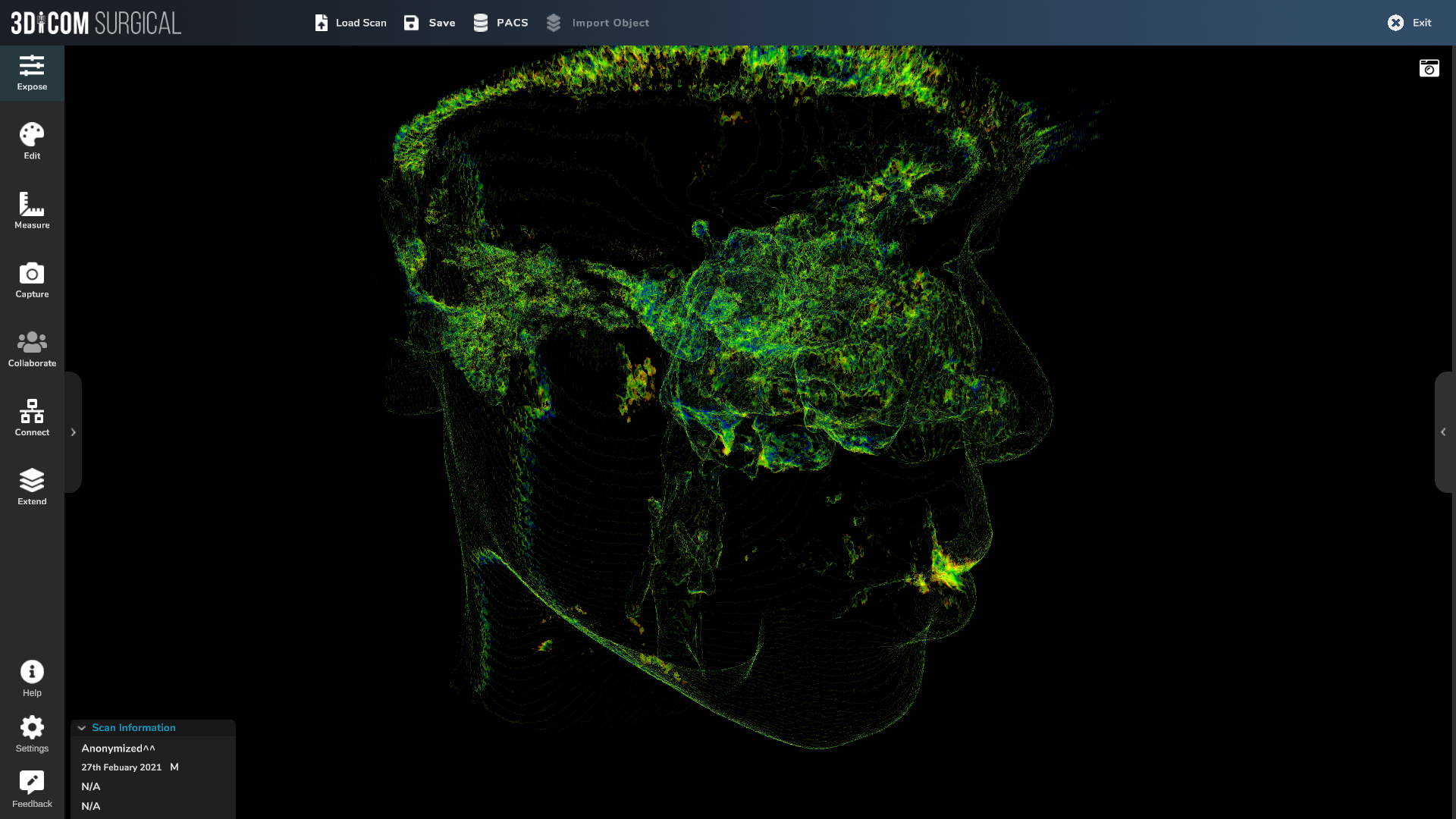 3Dicom - Visualise CT/MRI Scans In 3D gallery image