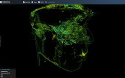 3Dicom - Visualise CT/MRI Scans In 3D media 2