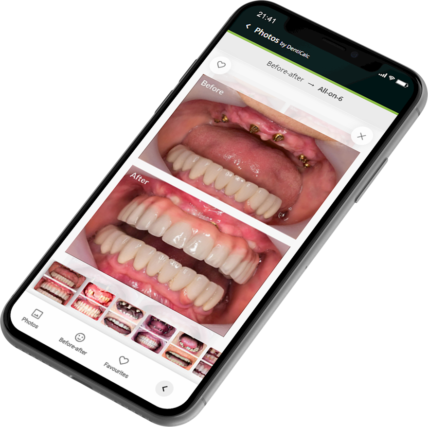 DentiCalc gallery image